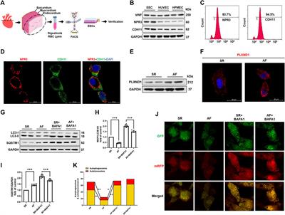 PLXND1-mediated calcium dyshomeostasis impairs endocardial endothelial autophagy in atrial fibrillation